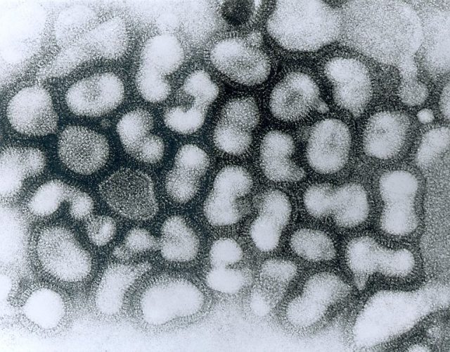 768px-influenza_a_-_late_passage