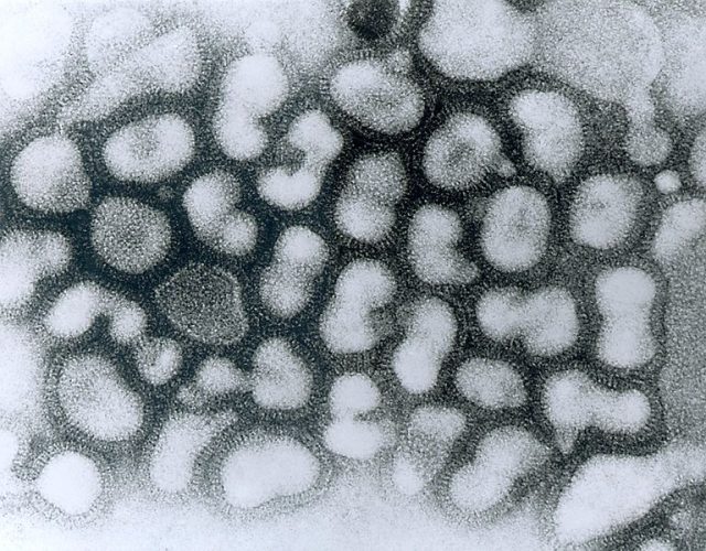 768px-Influenza_A_-_late_passage